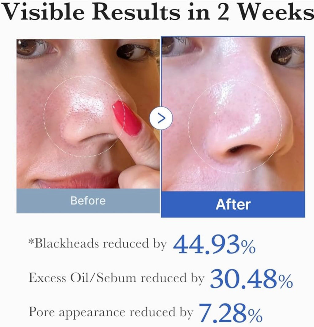 Zero Pore Pad 2.0  70-Pads