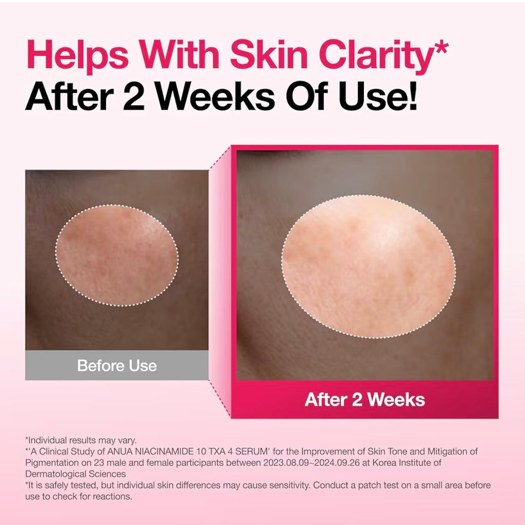 Anua Niacinamide 10% + TXA 4% Serum 30ML